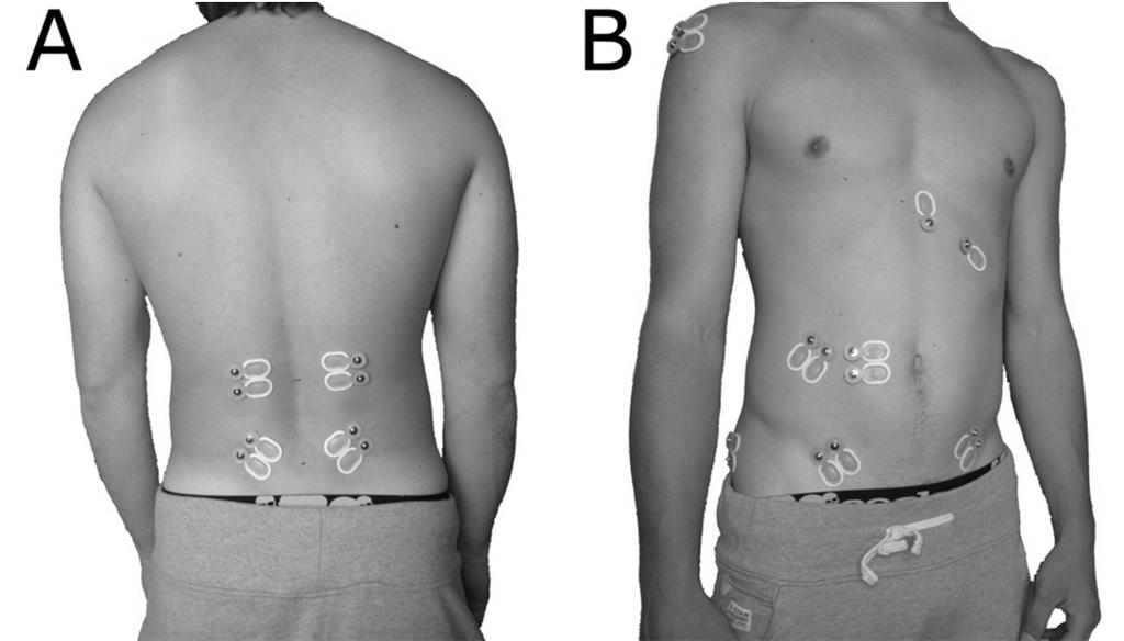 trnom črevnice (lat.: spina iliaca posterior superior), odmaknjeni lateralno 2 do 3 cm od sredine hrbta (Hibbs idr., 2011; Masani idr., 2009; Stokes idr., 2006).