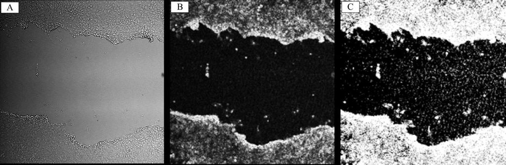 Kadunc L. Izražanje parakrinih dejavnikov matičnih celic za izboljšanje celjenja ran v in vitro modelu. 43 služile za orientacijo pri slikanju z mikroskopom.