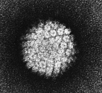 Slika 6: Okužbe s HPV (Hpvvaccination, 2014) Na spodnji sliki (slika 7) je prikazan virus HPV, viden z elektronsko mikroskopijo. Slika 7: Virus HPV (NCI Visuals Online, 1986) 1.