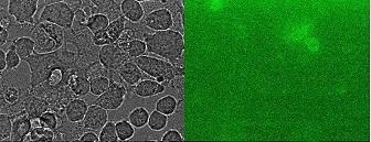 4.4 Fluorescenčna mikroskopija A 1 2 3 B C D Slika 8: HaCaT celice pod