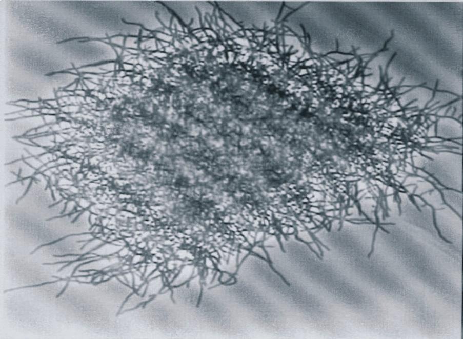 Slika 2-3: Gliva Streptomyces clavuligerus. 'povzeto po [15]' Zanimivo je, da so S.